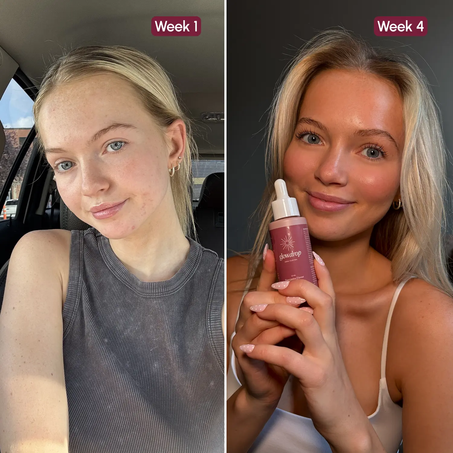 Before and after GlowDrop, week 1 and week 4, second person