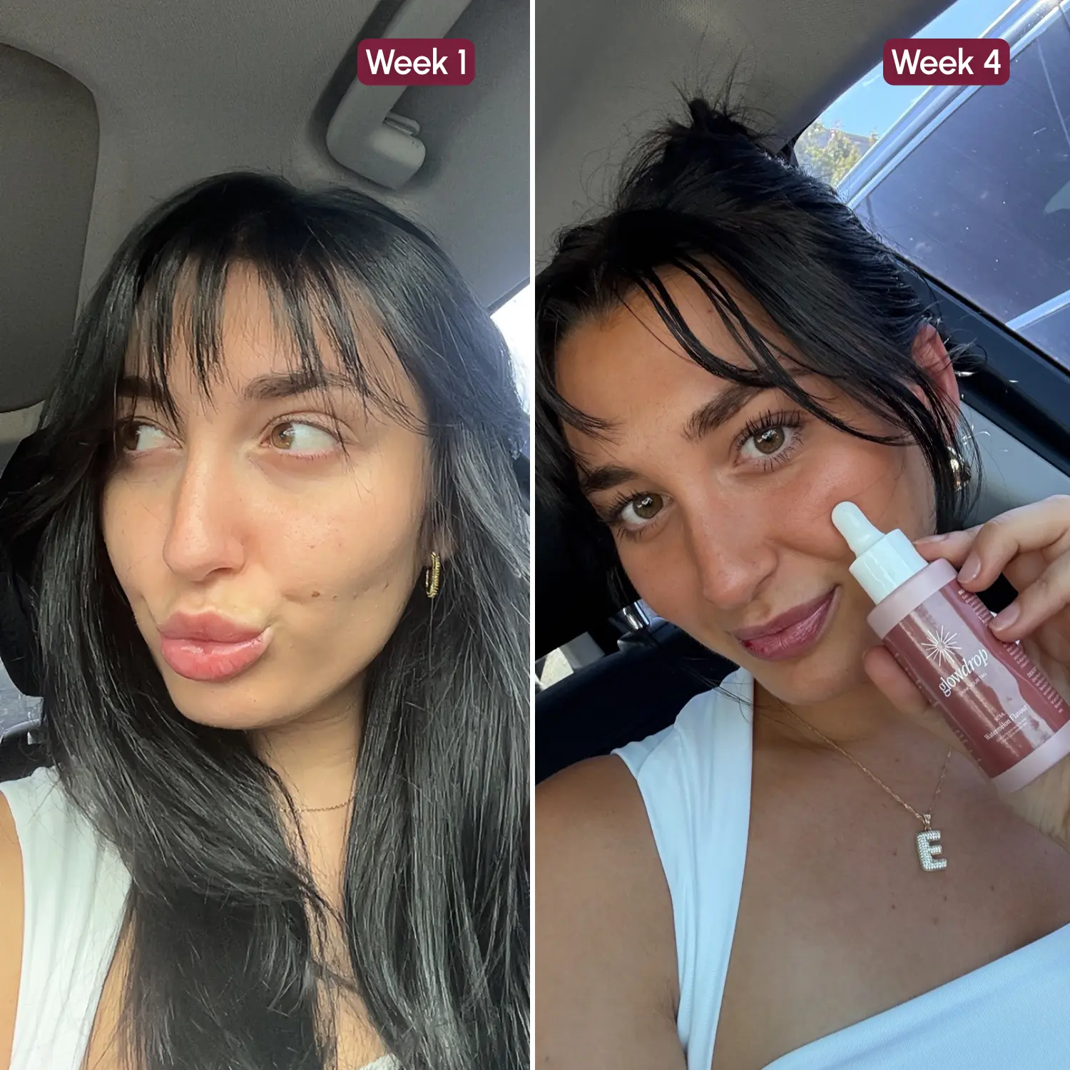 Before and after GlowDrop, fourth person
